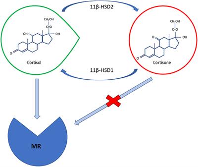 The Pathophysiology and Treatment of Hypertension in Patients With Cushing's Syndrome